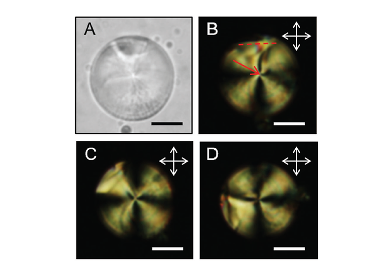 Patterned Surface Anchoring of Nematic Droplets at Miscible Liquid-Liquid Interfaces